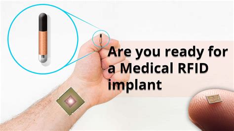 rfid chips in skin|Human Microchipping: An Unbiased Look at the Pros and Cons.